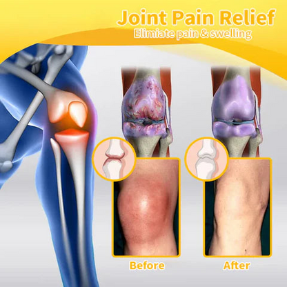 Alisanda™Bee Essence-Infused Relief for Bones & Joints The last time you'll struggle with joint pain and bone discomfort!