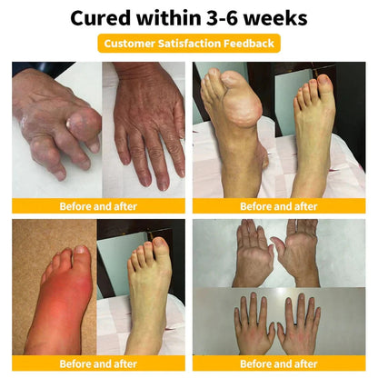 Alisanda™Bee Essence-Infused Relief for Bones & Joints The last time you'll struggle with joint pain and bone discomfort!