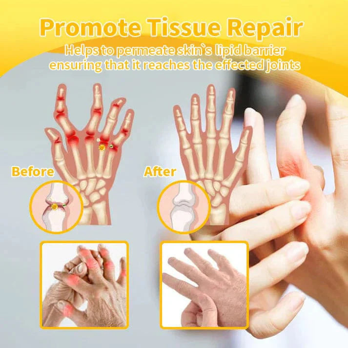Alisanda™Bee Essence-Infused Relief for Bones & Joints The last time you'll struggle with joint pain and bone discomfort!