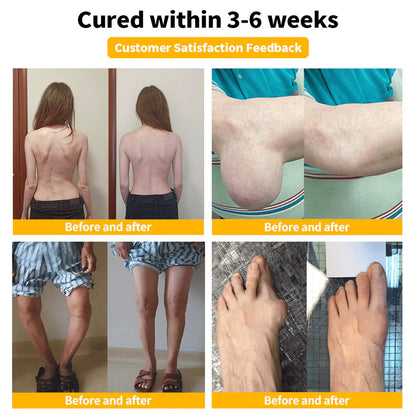 Alisanda™Bee Essence-Infused Relief for Bones & Joints The last time you'll struggle with joint pain and bone discomfort!